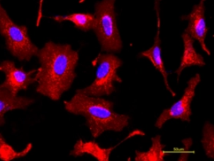 FITC-WFA荧光素标记紫藤凝集素（WFA，WFL），Fluorescein labeled Wisteria Floribunda Lectin (WFA, WFL)